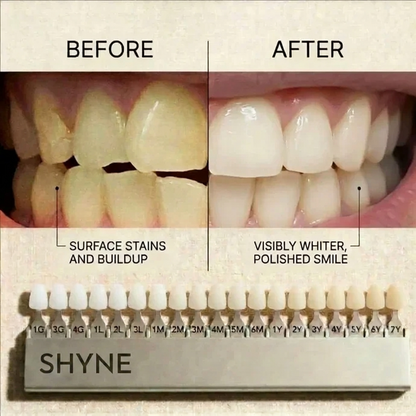 Shyne® Teeth Whitening Booster Powder
