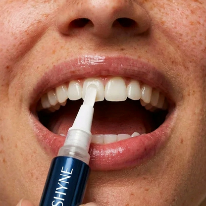Shyne® OverNight Teeth Whitening Pen