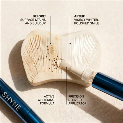 Shyne® OverNight Teeth Whitening Pen