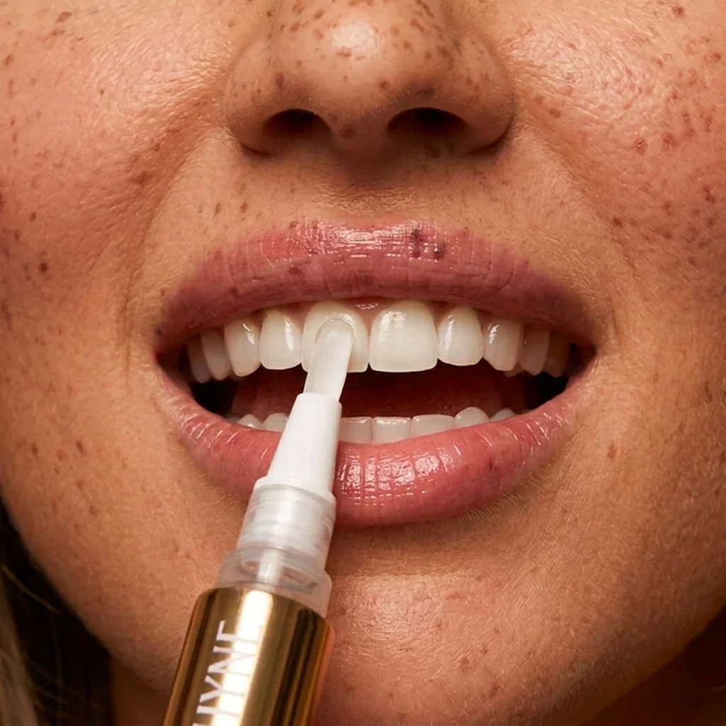SHYNE® Teeth Whitening Pen+ (Extra Strength)