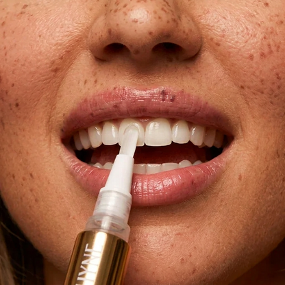 SHYNE® Teeth Whitening Pen+ (Extra Strength)